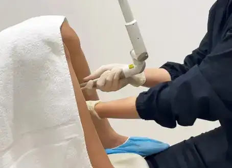 Lazer Vajinal Gençleştirme